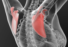 Scapulohumeral Rhythm (SHR)