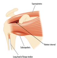 Supraspinatus Muscle